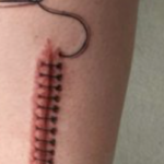 tatouage de cicatrice