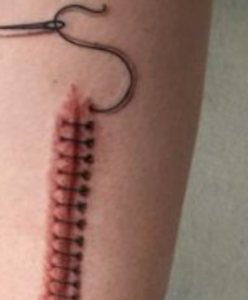 tatouage de cicatrice
